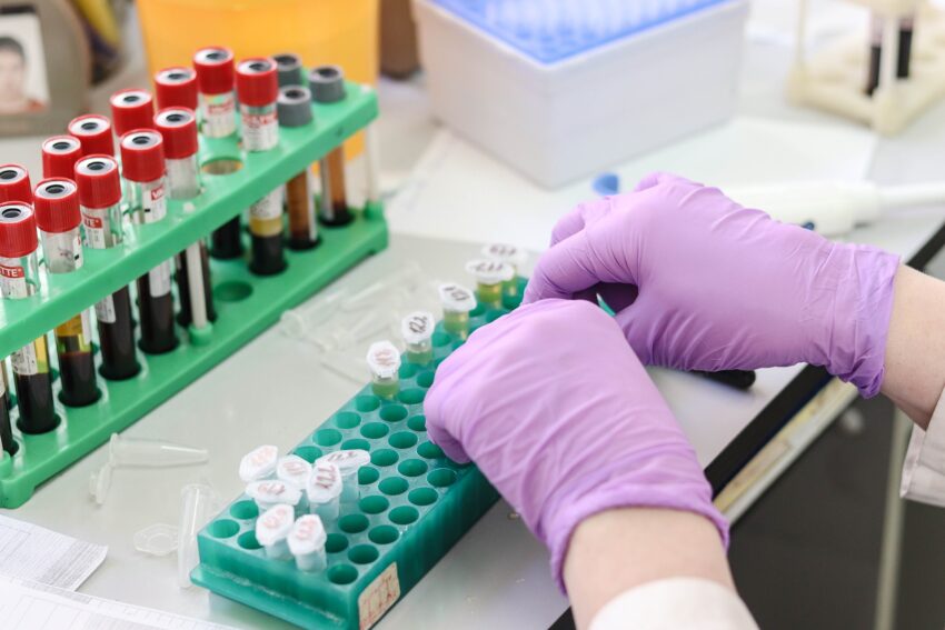 Analisi del sangue e urine